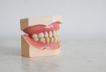 Torrance dental care