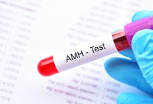 AMH Test