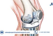 Knee Replacement Market