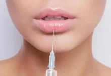 What Is Juvederm Ultra Plus XC Used For?