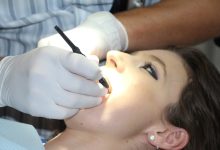 Houston Prosthodontist